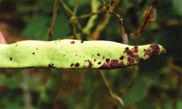 如何防治菜豆炭疽病，其病原菌是什么？
